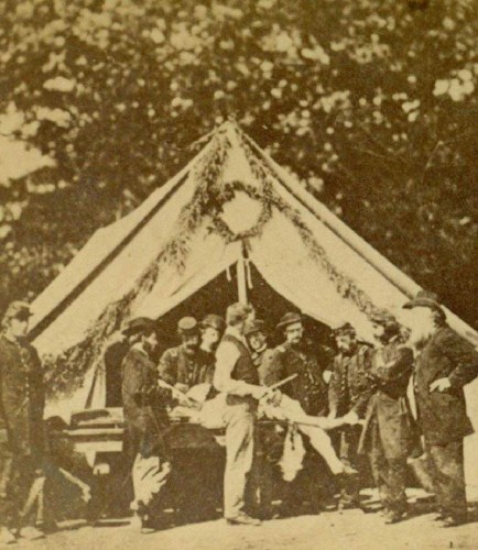 1863 Civil War Camp Letterman Gettysburg Amputation